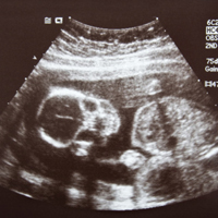 Календарь беременности: изображение плода на 19 неделе развития (ультразвук) 
