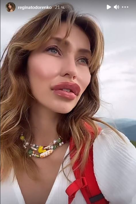 Регина Тодоренко губы