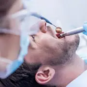 Установка зубного импланта: все, что нужно знать