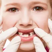 Вредные привычки детей, которые приводят к проблемам с зубами во взрослом возрасте