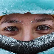 Обморожение и переохлаждение: причины, признаки и первая помощь