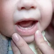 Елена Анциферова: Как прорезаются зубы у малышей
