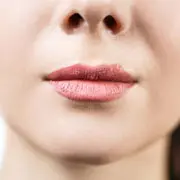 Герпес на губах: как лечить