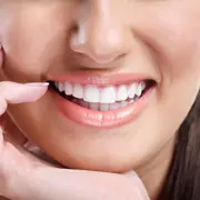 Марина Колесниченко: Как отбелить зубы без вреда: отбеливающие полоски или лазер?