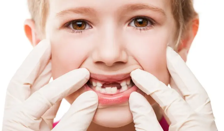 Вредные привычки детей, которые приводят к проблемам с зубами во взрослом возрасте
