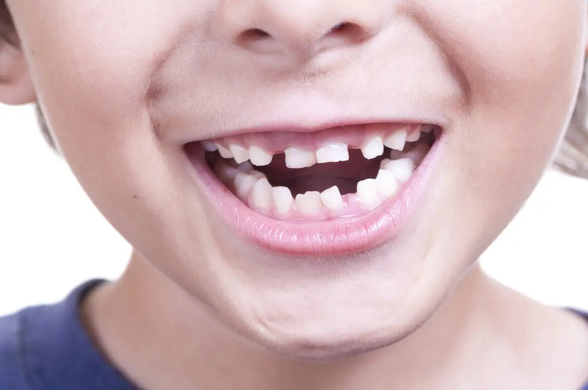 Зубные проблемы у детей