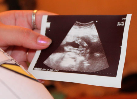 42 недели ожидания: рождение сына после дочки