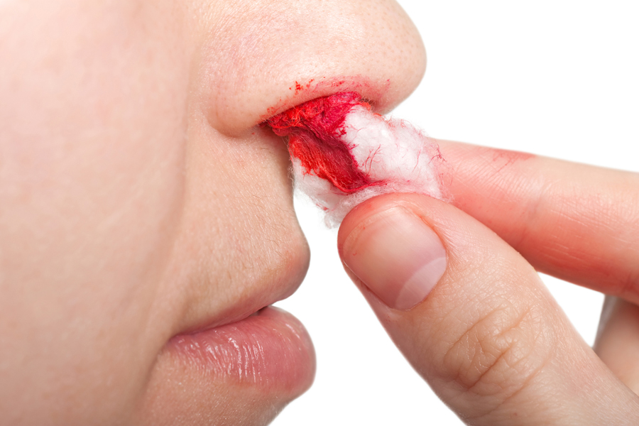 Как остановить кровь из носа