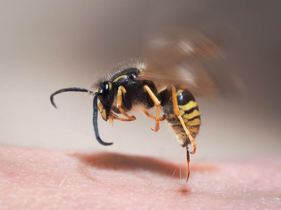 Аллергия на укусы пчел и ос