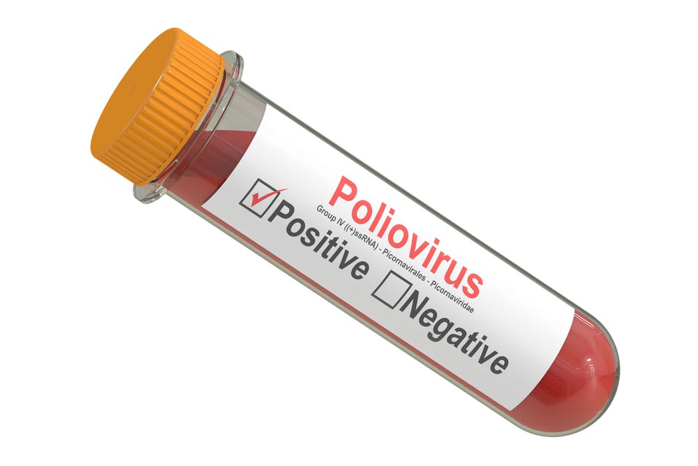 Живая вакцина против полиомиелита