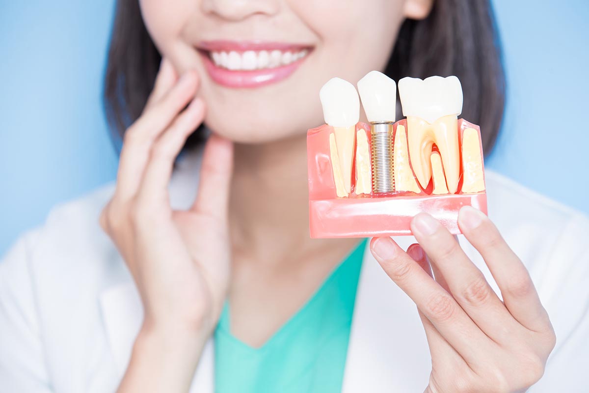 Сколько прослужат зубные имплантаты