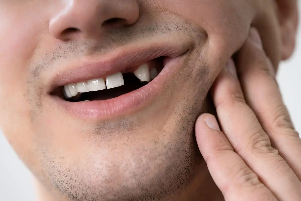 Каковы риски потери зубов?